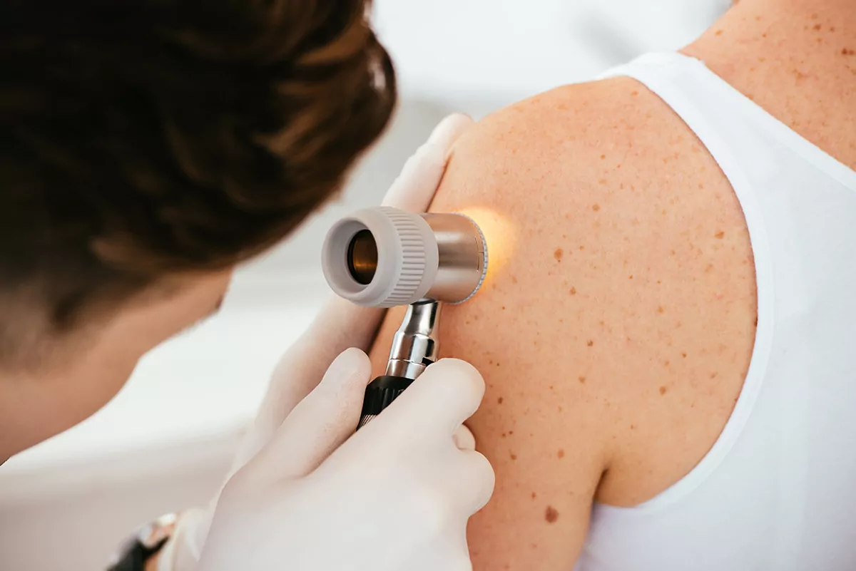Canterbury Charity Hospital to host free skin check day