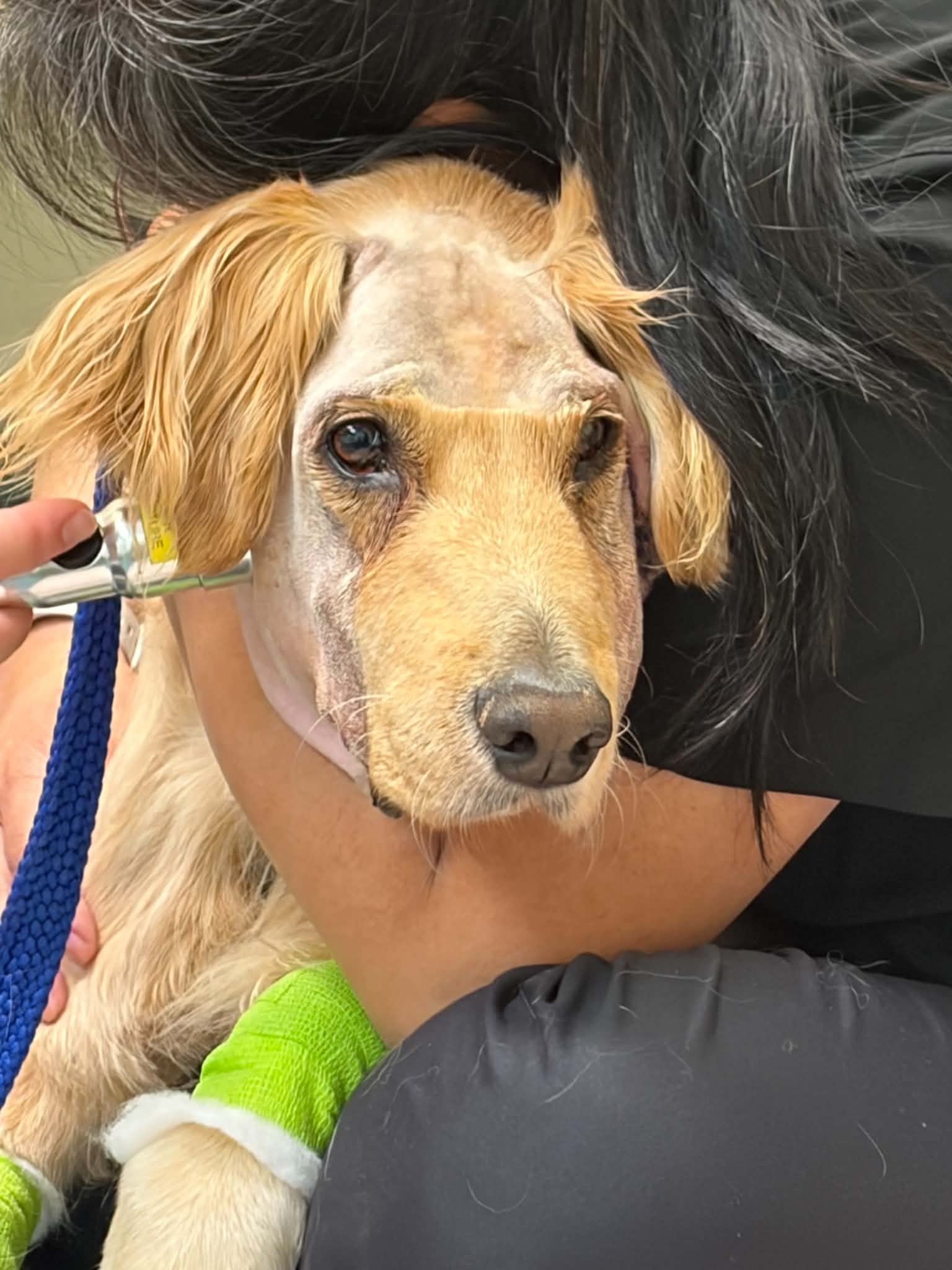 Mak having Laser Therapy Treatment
