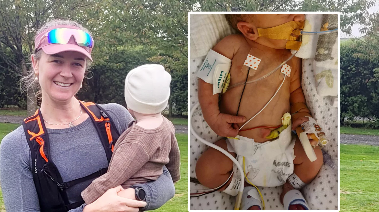 ‘He wasn’t meant to survive’ parents of miracle baby mark his first birthday with 500km charity run