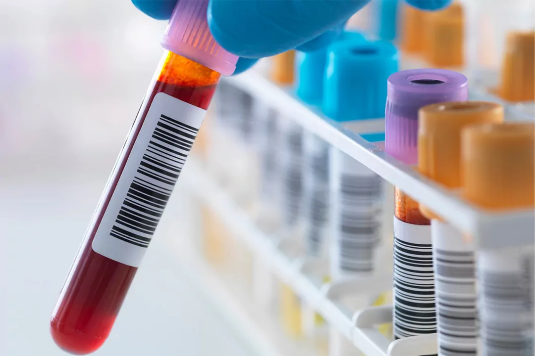 New Rolleston blood collection centre to open